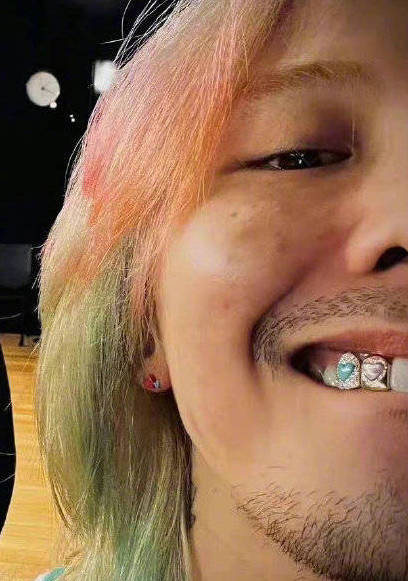 权志龙分享镶牙钻照片一蓝一粉十分炫酷