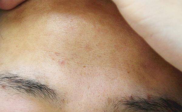 原创毛孔粗大干燥暗沉多是错误的洗脸方式所致小心脸越洗越糟