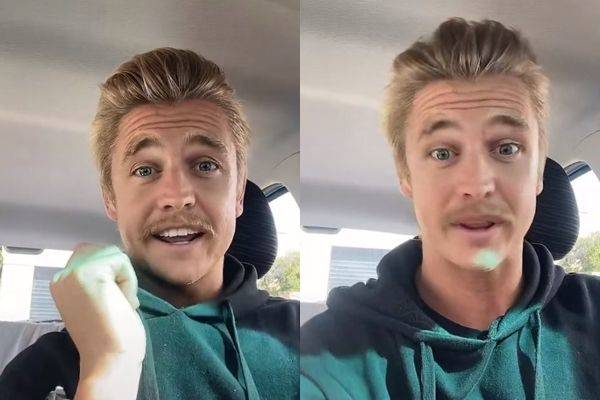秃头男 戒掉洗发精 改用清水洗头 6年后发量奇迹暴增 头发 尼克 Tiktok