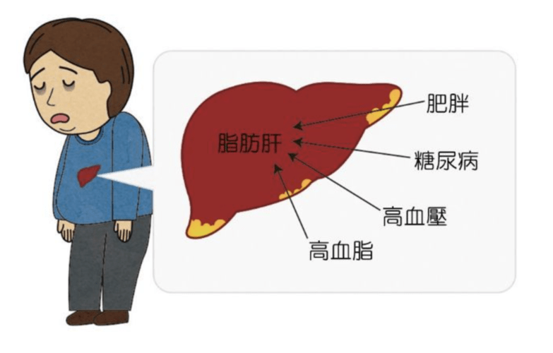 肝脏不好，身体先知！这五“症状”一个不占，身体还算健康