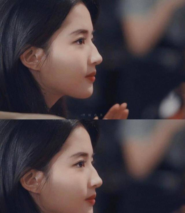 鼻子_鼻梁_严重