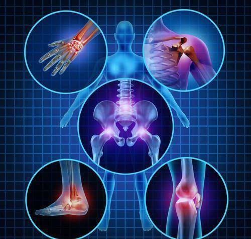 原创四肢疼痛原因不只是风湿关节炎没有控制好血糖水平可能犯病