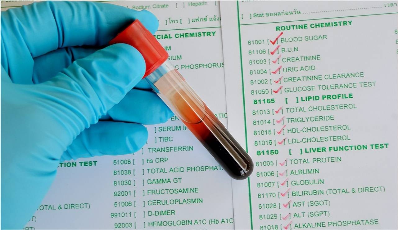 甘油三酯超标的人常吃这5种食物容易升高血脂能不吃就不吃