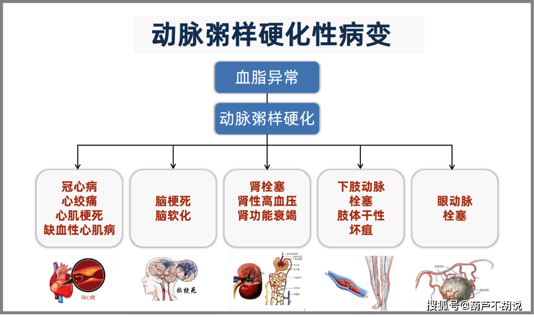 警惕动脉硬化5大征兆,负离子发挥防治功效_血液_治疗_氧化