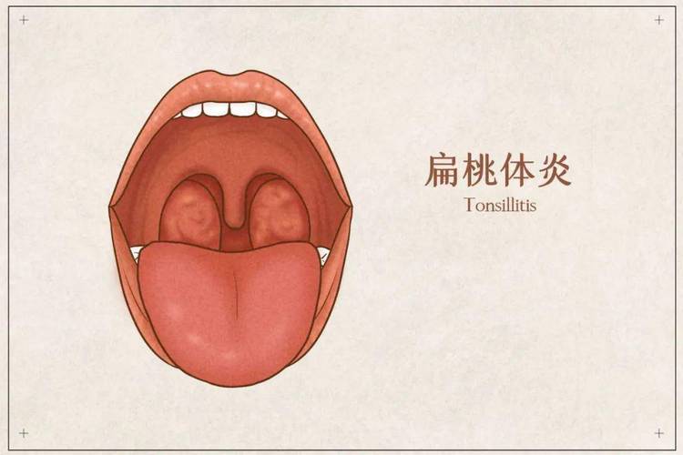 兒童特輯孩子撞上腺樣體扁桃體家長們該怎麼處