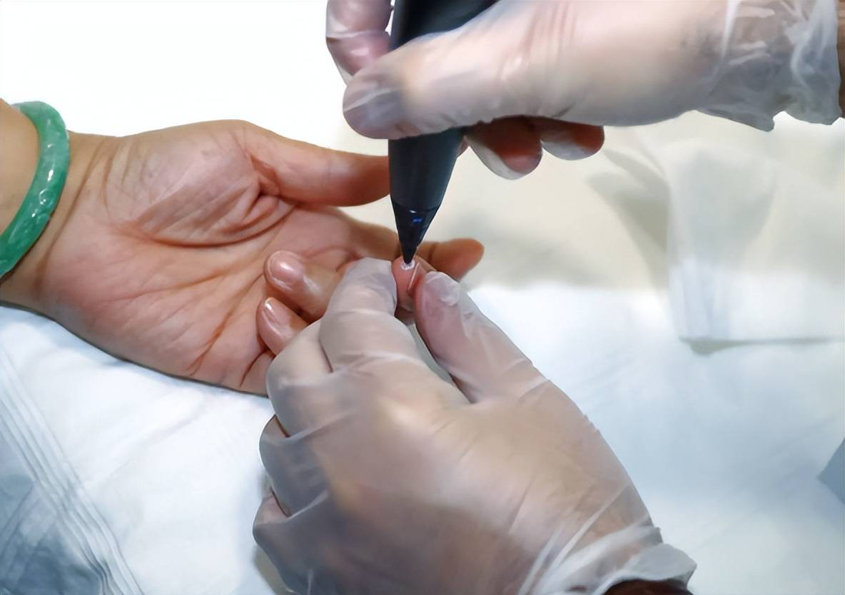 另外,无论是否长疣体,对于hpv感染的人,都要尽快提高机体免疫力,清除