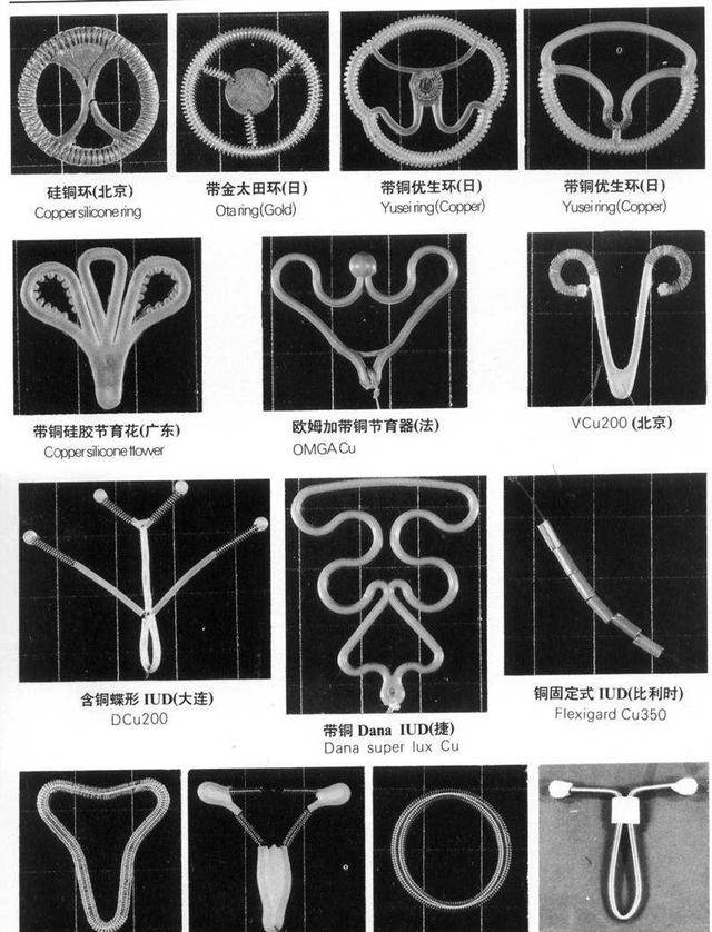 51岁阿姨被迫摘除子宫,原来环也有保质期_女性_上环_年限