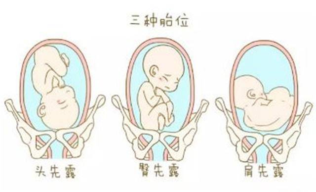 想顺产生宝宝，除了双顶径外，这些条件也得全满足！