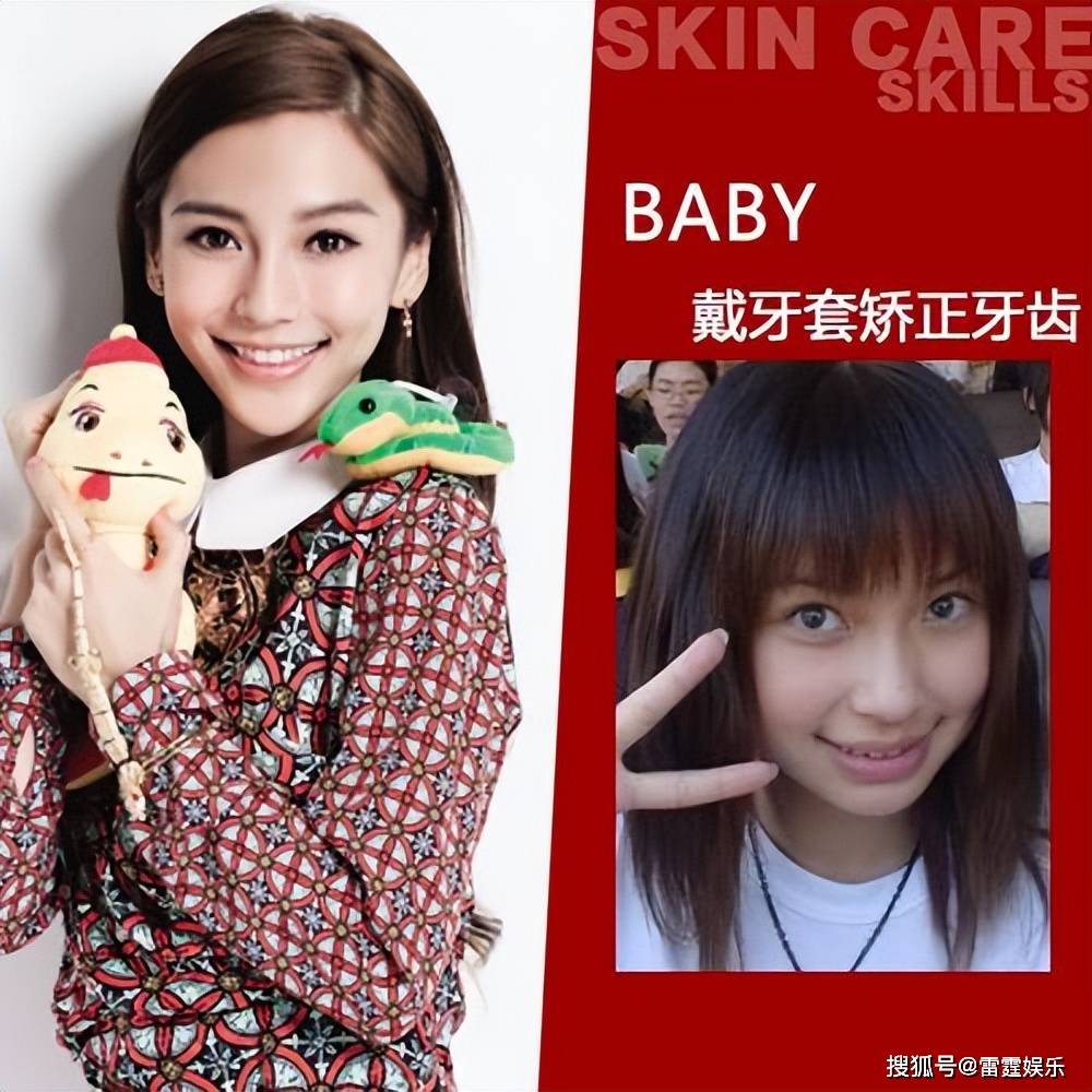 baby确实其貌不扬,五官不够立体,还有些婴儿肥,皮肤也偏黑还带着牙套