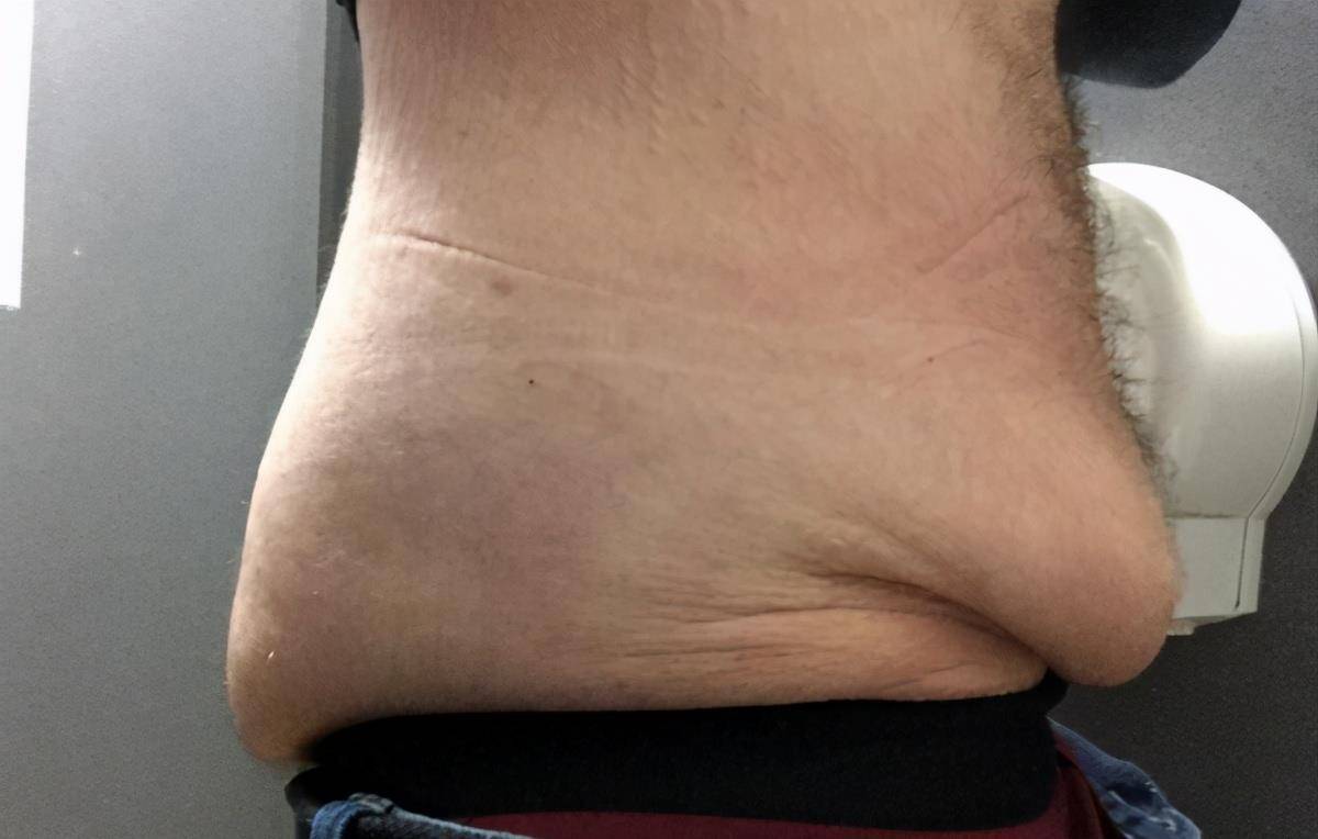 原创贾玲想要瘦下来有多难看完这个你就不会坚持劝她减肥了