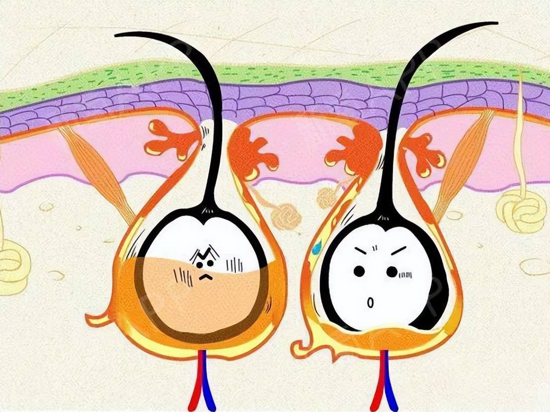 毛囊_头发_患者