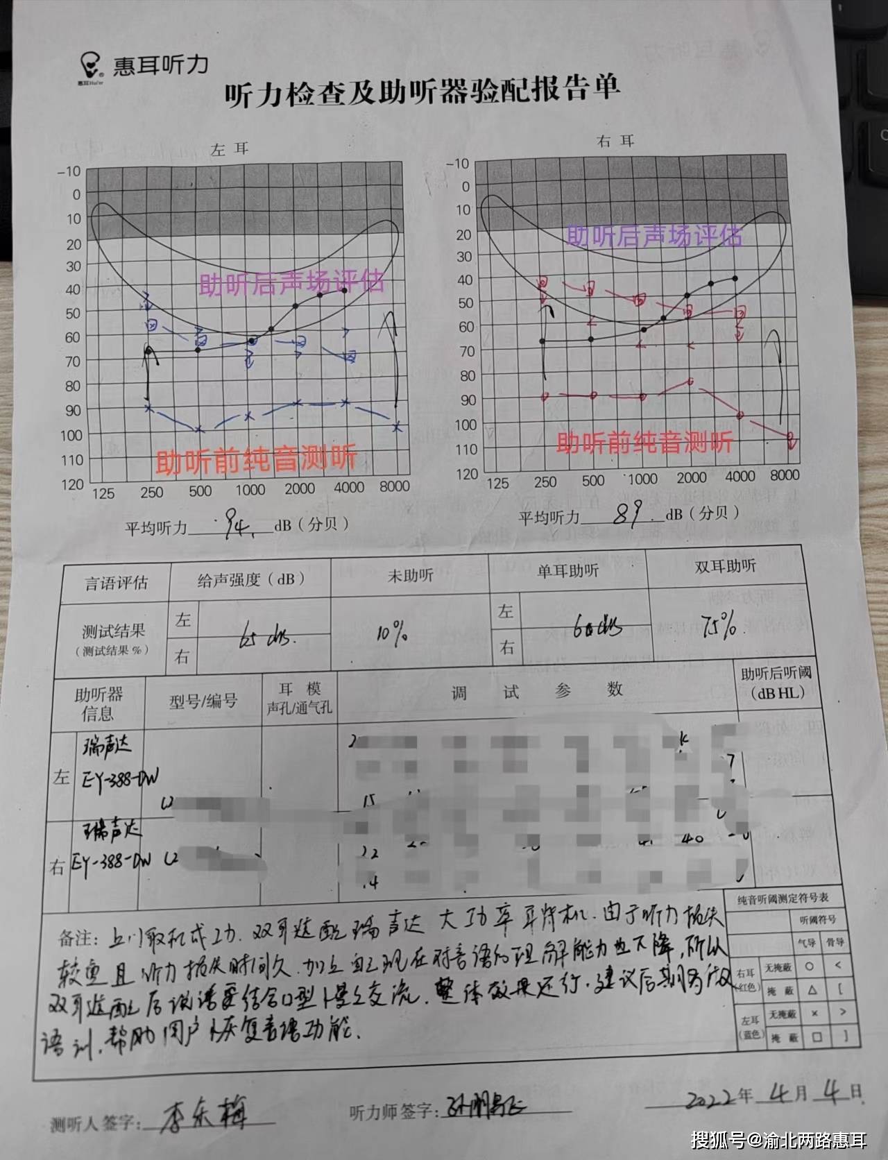 渝北双凤路惠耳助听器案例分享