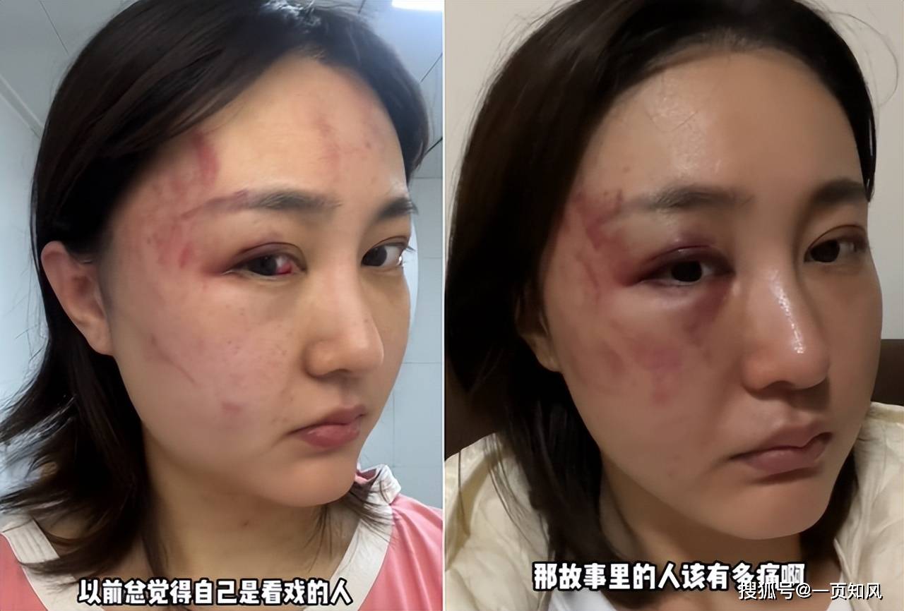 原创徐大宝曝丈夫家暴曾在红毯上力压范冰冰男方称妻子出轨才打人