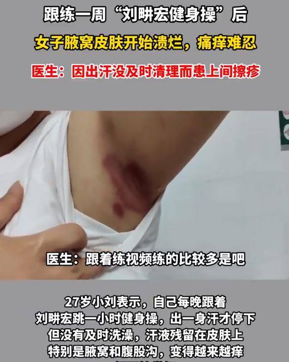 女孩跟刘畊宏跳操不洗澡致腋窝溃烂，网友：无语