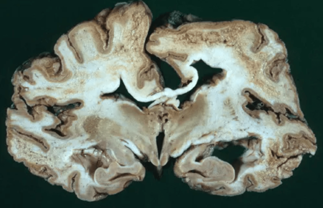 神的禁令写在人类20号染色体上神要禁止人类做何事