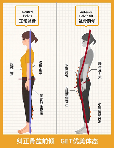直乐大讲堂:小肚腩总甩不掉,当心骨盆前倾盯上你!_腰椎_影响_危害