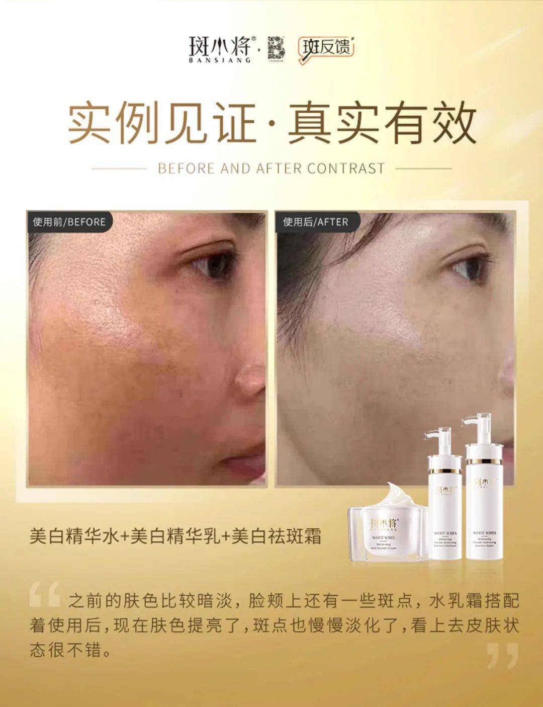 斑小将护肤 | 这个祛斑手段看似黑科技,实则毁容利器_色斑_皮肤_肌肤