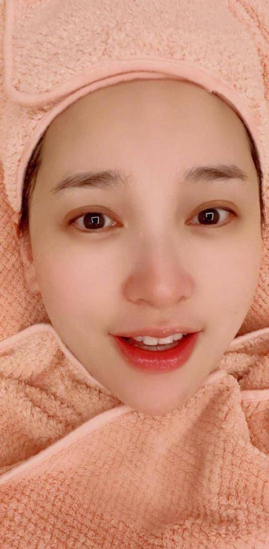 原创38岁金莎自曝身体亮红灯原因惹人担忧晒自拍皮肤却美似少女