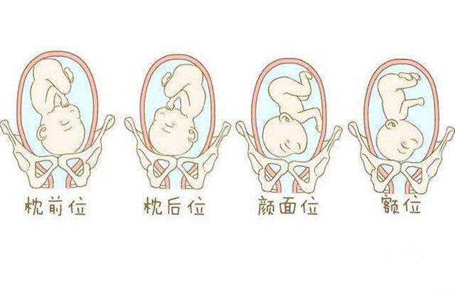 37周右枕前位胎儿图图片