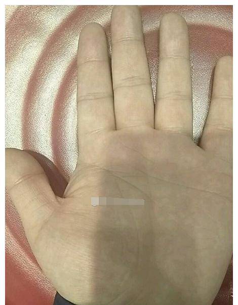 从手掌中看,右手形成了一种鸡爪纹,感情线尾部低垂,和智慧线相连,这样