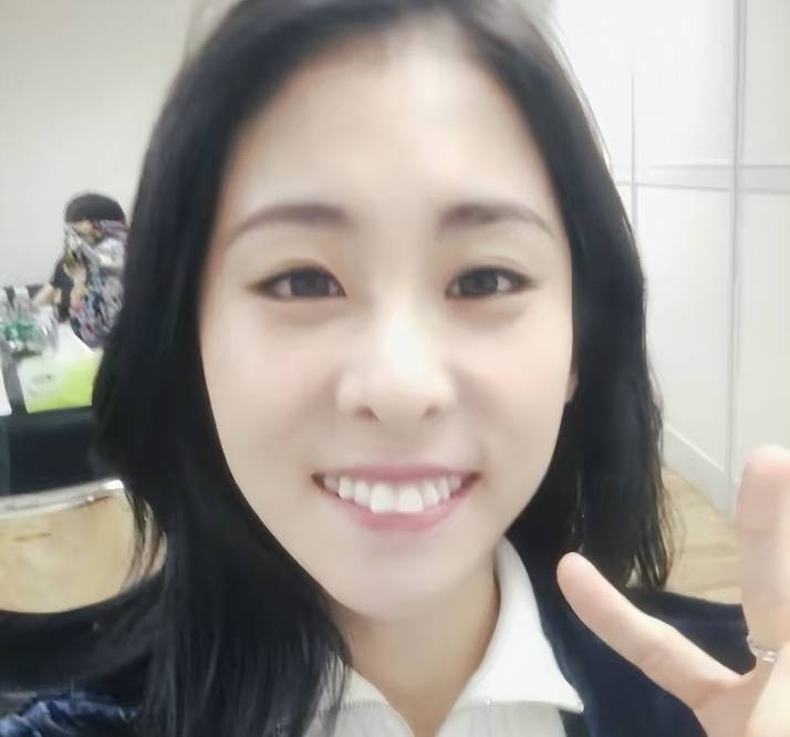 龅牙,假牙,大板牙,这12位女星貌美如花,却都"输"在了牙齿上