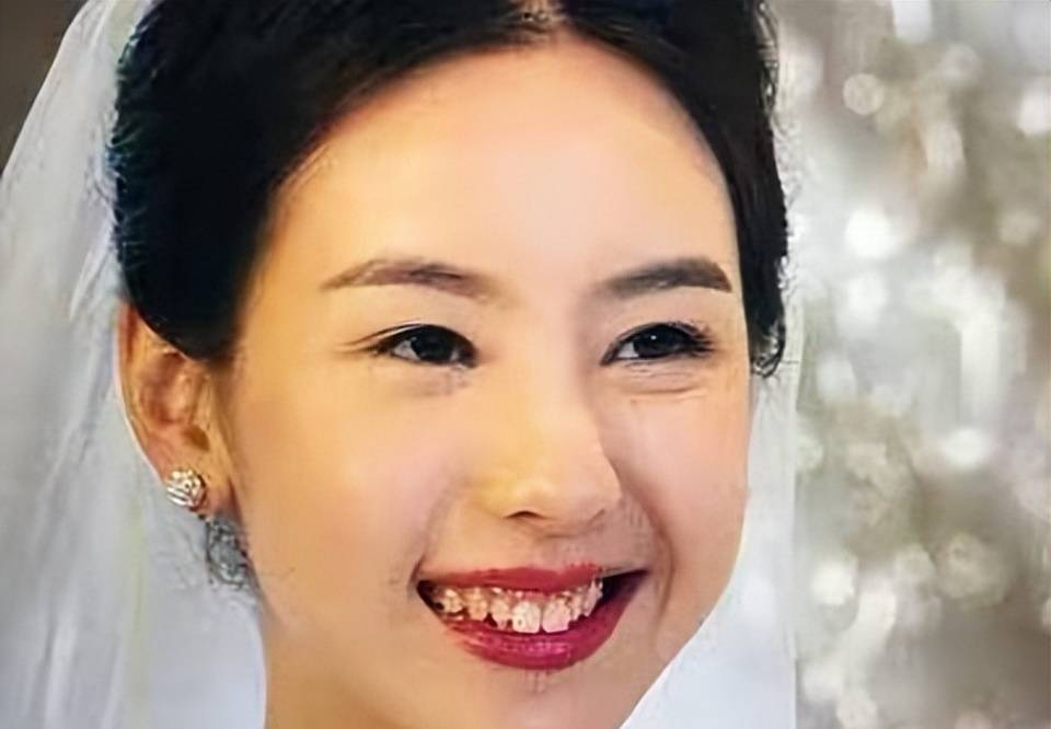 龅牙,假牙,大板牙,这12位女星貌美如花,却都"输"在了牙齿上