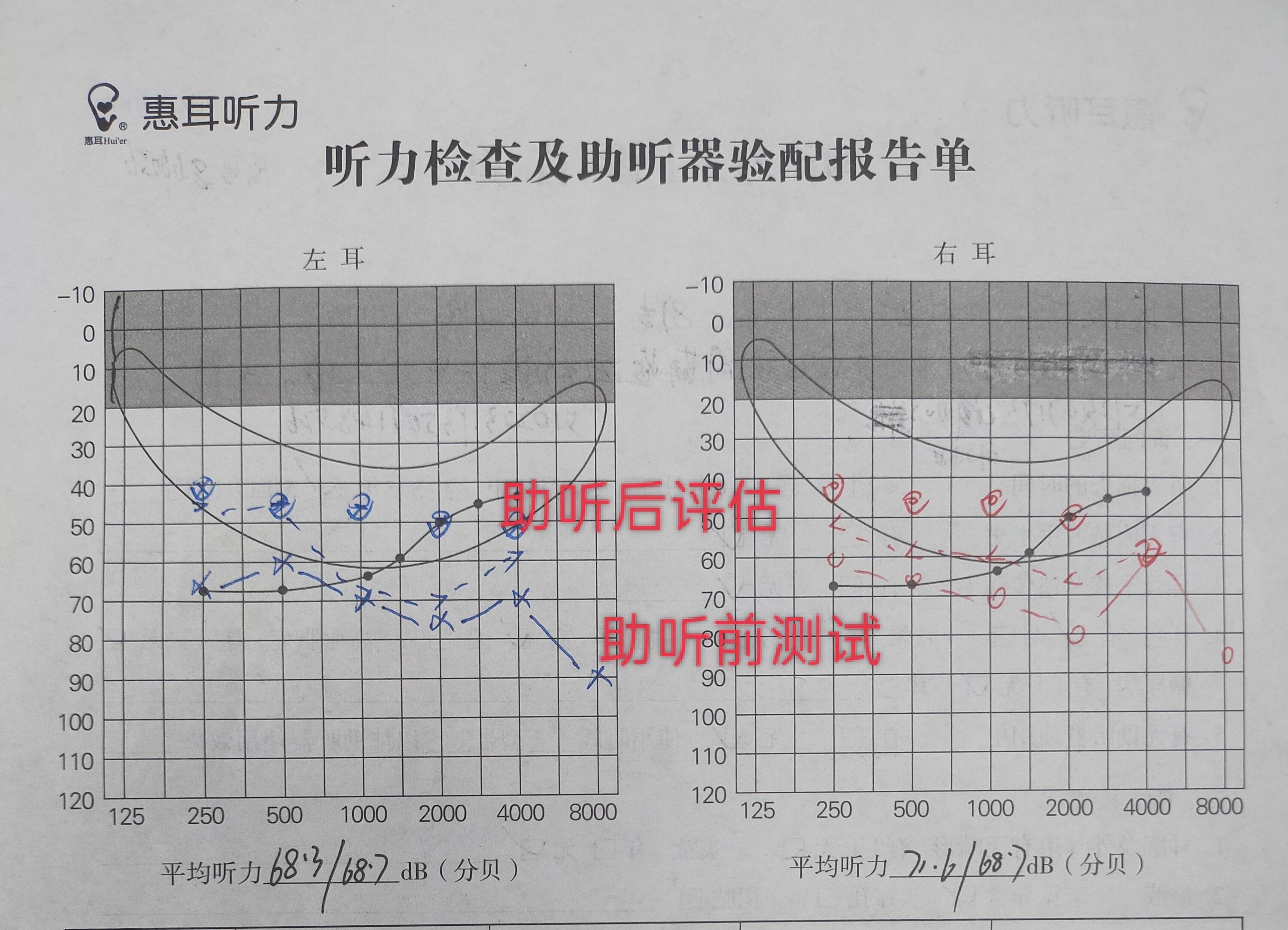 耳镜检查报告图片图片