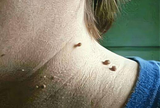 看完就明白了_皮肤_身体状况_脂肪