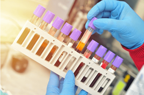 elisa实验样本如何处理?读这篇就够了_细胞_检测_裂解