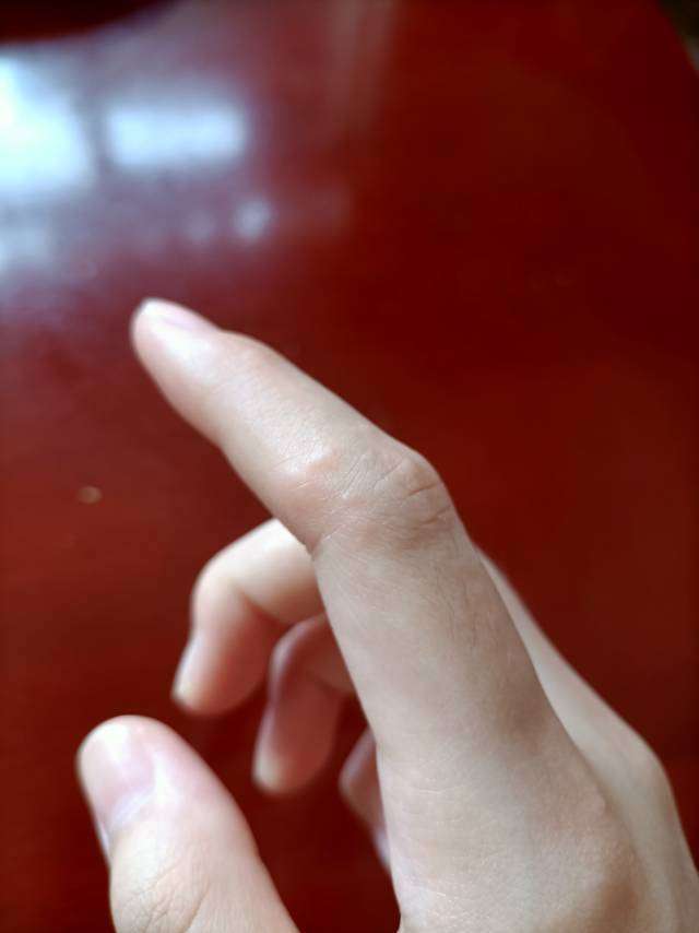 手指痒挠后有小水泡是怎么回事?我是过敏体质
