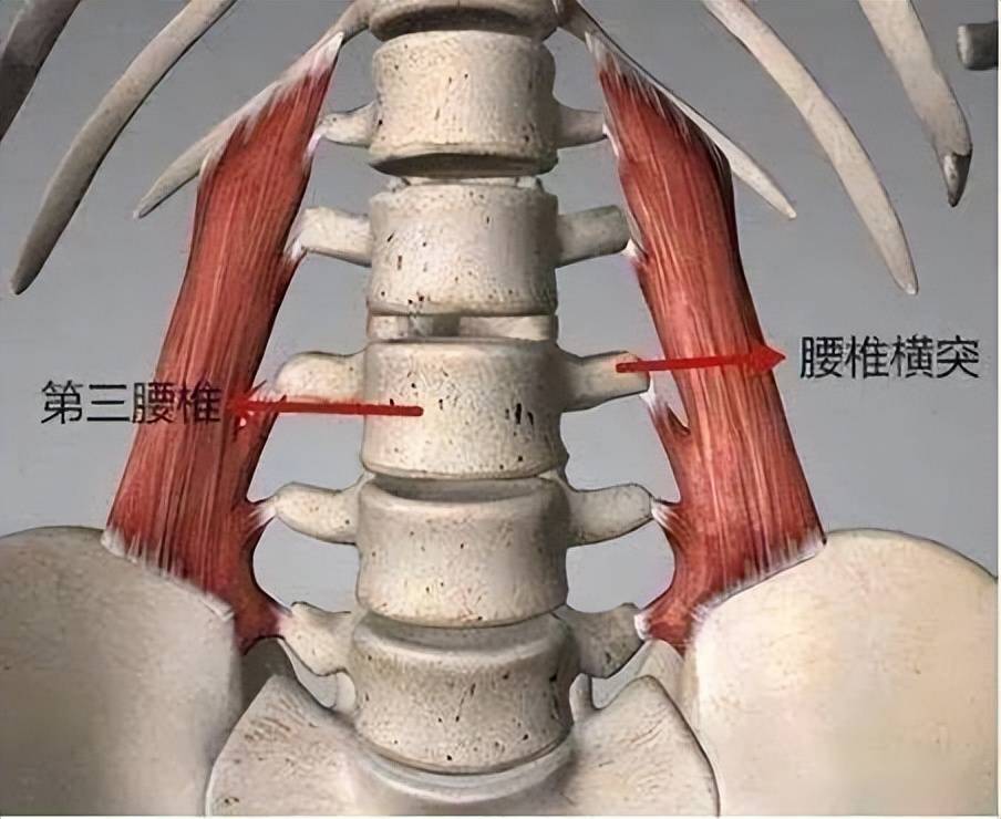 一侧腰痛可能是第三腰椎横突综合征它的治疗方法是这样的