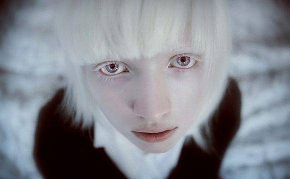 世上没有天然的粉色眼睛,只有白化病导致眼睛色素缺失出现这种特殊的