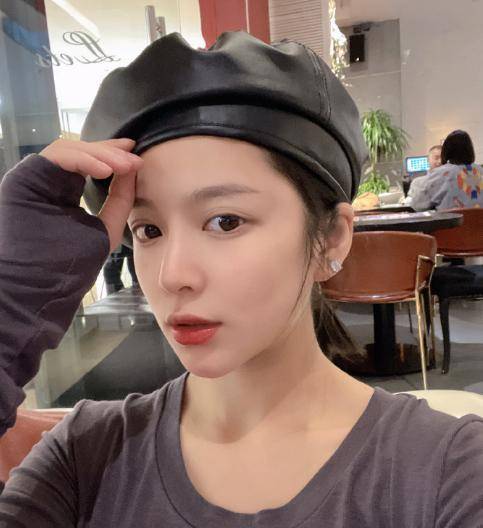 杜淳妻子王灿为证没整容,晒年轻时照片,称"疤痕体质"不敢动刀_质疑