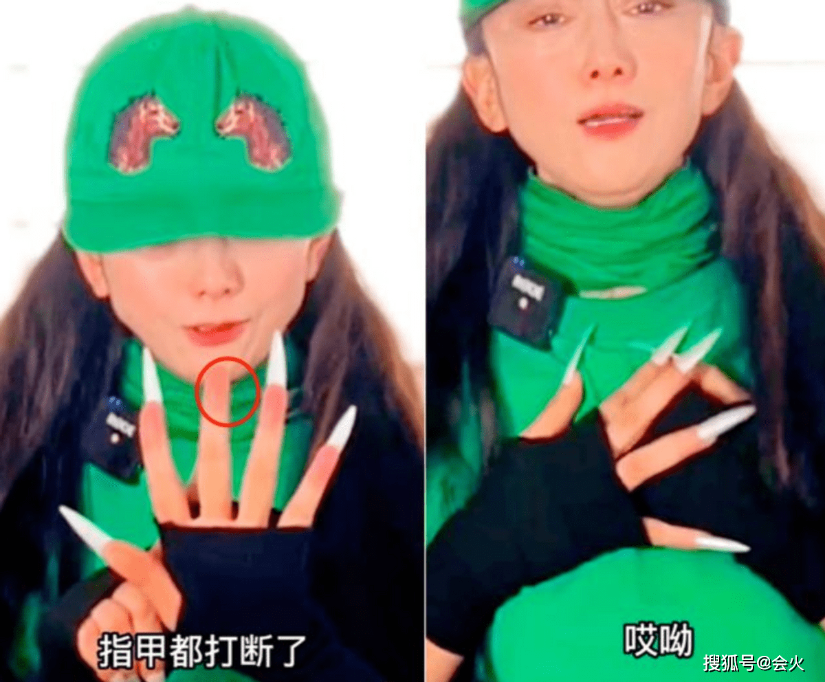 63岁杨丽萍眼睛开裂受伤!脸上包纱布上台谢幕