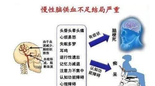 哪些原因会导致脑供血不足？该如何改善？医生这么说