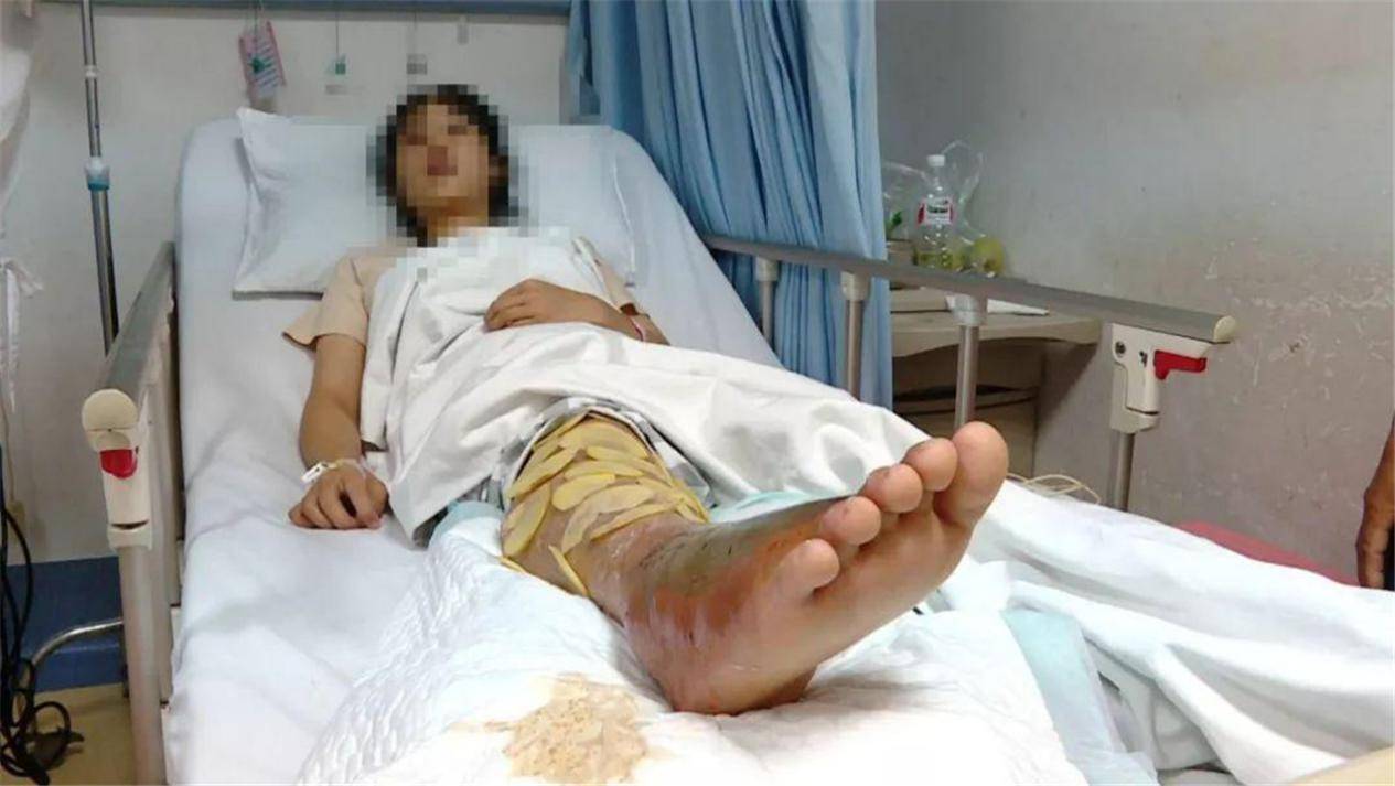 原创人被蛇咬了会中毒那为什么喝蛇的毒液却没事