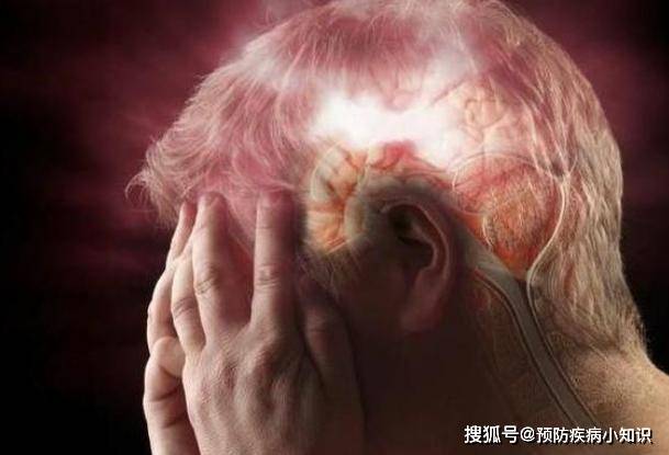 脑梗是怎么来的？提醒：睡觉时若出现5种现象，或要尽量引起重视