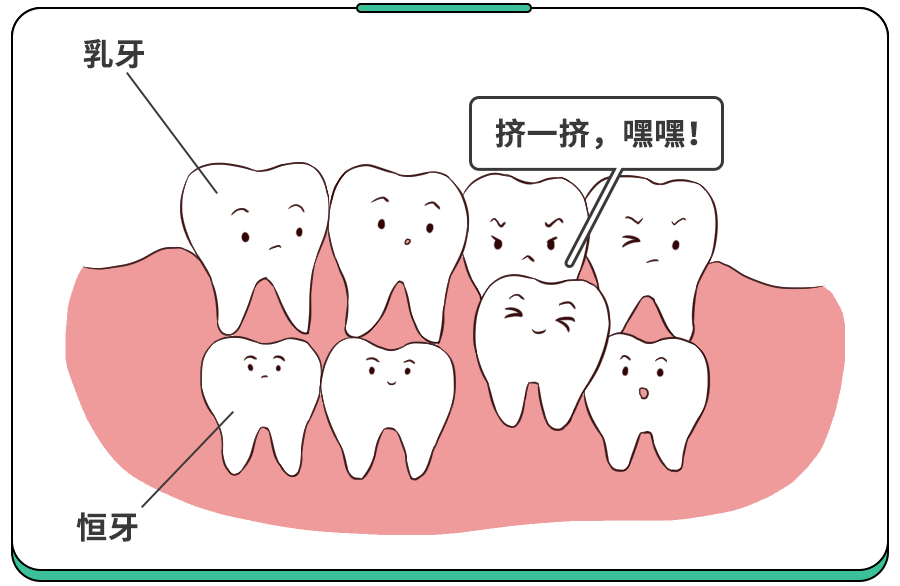 孩子牙齿不齐到底有没有必要正畸矫正吗？