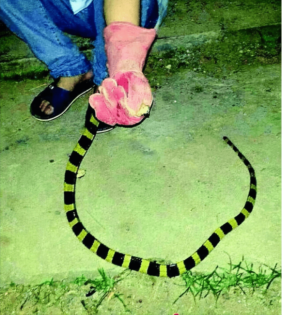 毒蛇_伤口_进行