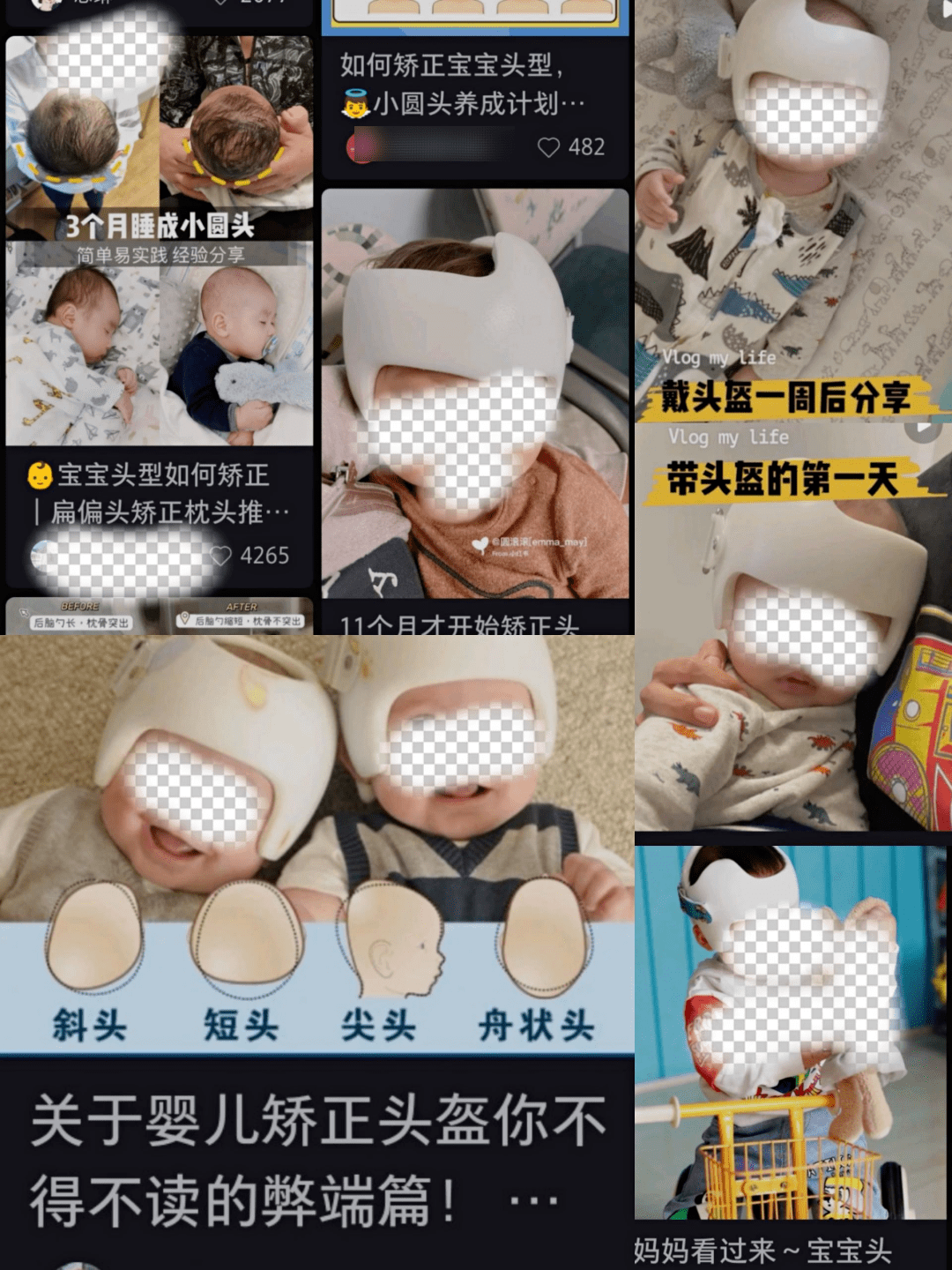 原本我以为孩子头上戴的只是防撞头盔,但是仔细一看,这是一个婴儿头部