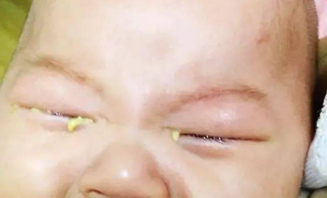 先看看这些再说!_家长_补充_症状