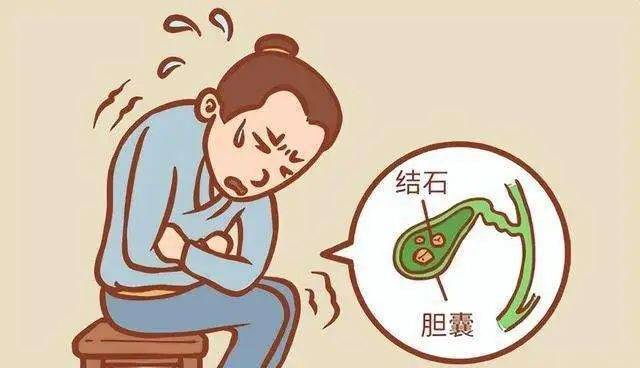 百姓健康 | 养成良好习惯,远离胆道疾病_胆囊_胆固醇_胆管