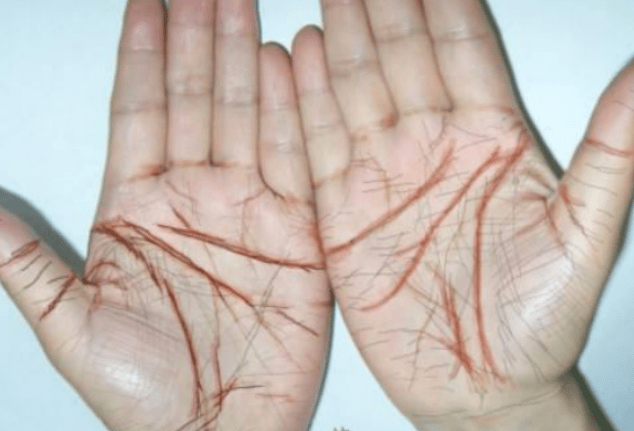 5个标志望你1个不占,你的肝健康_脚底_身体_皮肤