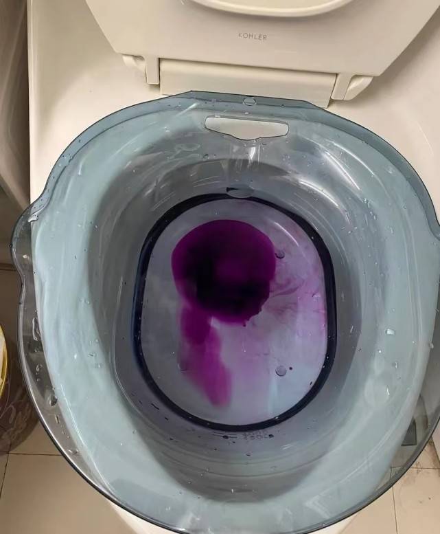 高锰酸钾坐浴浓度 来自搜狐网