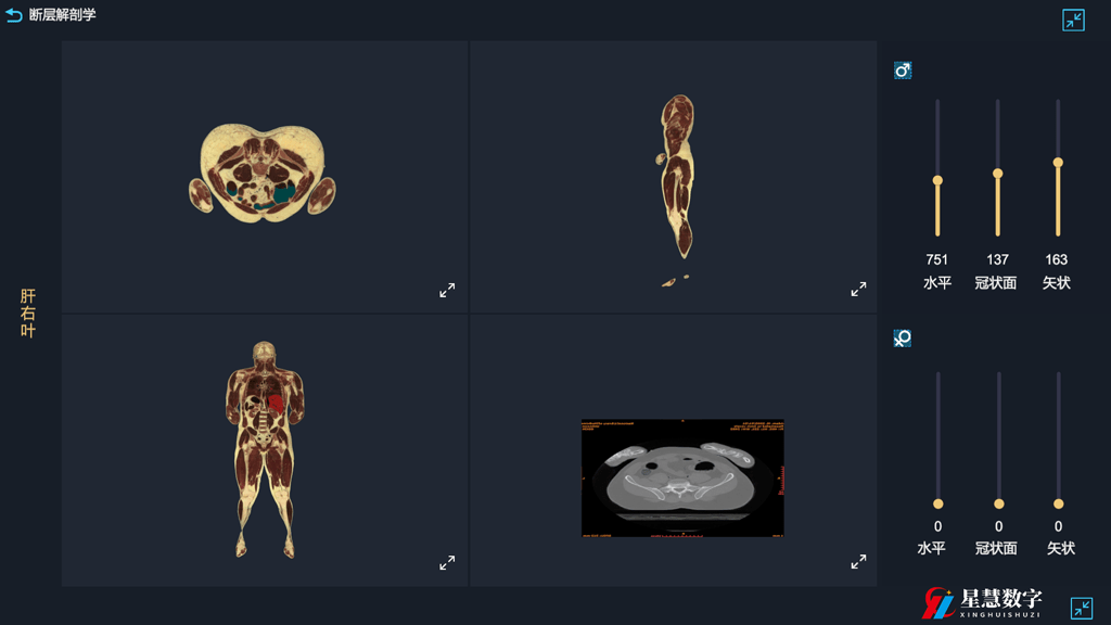 3d人体解剖软件