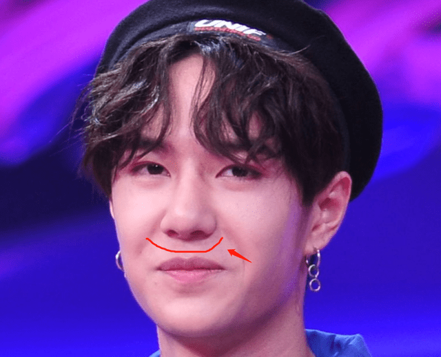 王一博鼻子疤痕又暴露了?