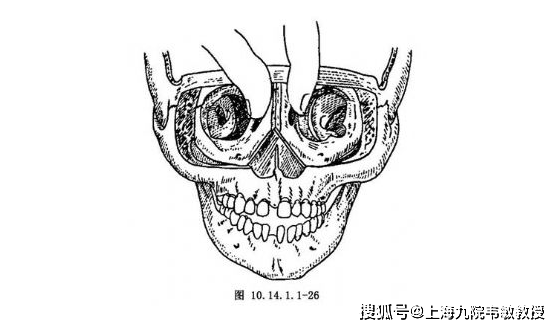 九院韋敏 | 眶距增寬症相關科普(二)_手術_進行_中心