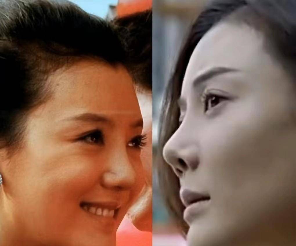 原来车晓的鼻子又塌又大,虽谈不上好看,但胜在自然协调,不影响整体的