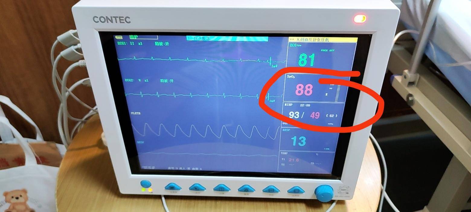 "沉默性缺氧引发关注",家用血氧仪已一货难求!_饱和度_患者_吸氧