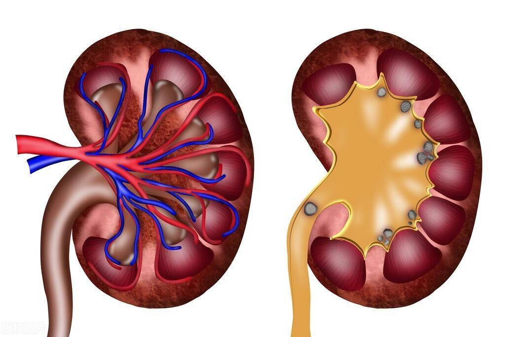 改善腎小球血液循環用藥及營養補給,需要採取中西醫聯合治療的方案.